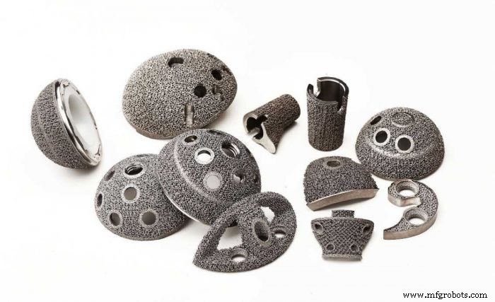 Knochenimplantate revolutioniert: Wie 3D-Druck Passform, Langlebigkeit und Performance verbessert