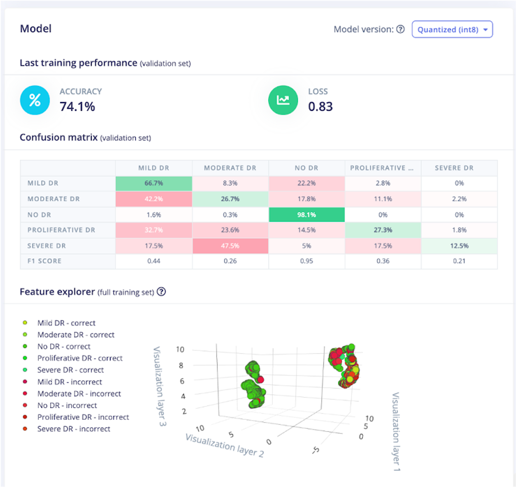 Offline AI Model für Diabetische Retinopathie Stages Detection mit Edge Impulse bauen