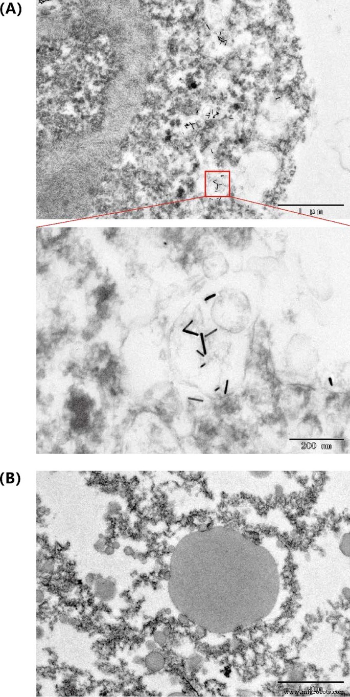 BSA-beschichtete Goldnanostäbe ermöglichen Low-Dose NIR-II Photothermische Therapie