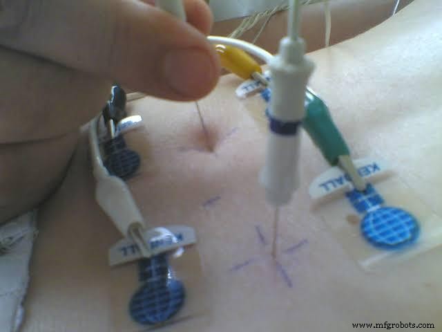 EMG-Sensor erklärt: Funktionsweise & Praktische Anwendungen