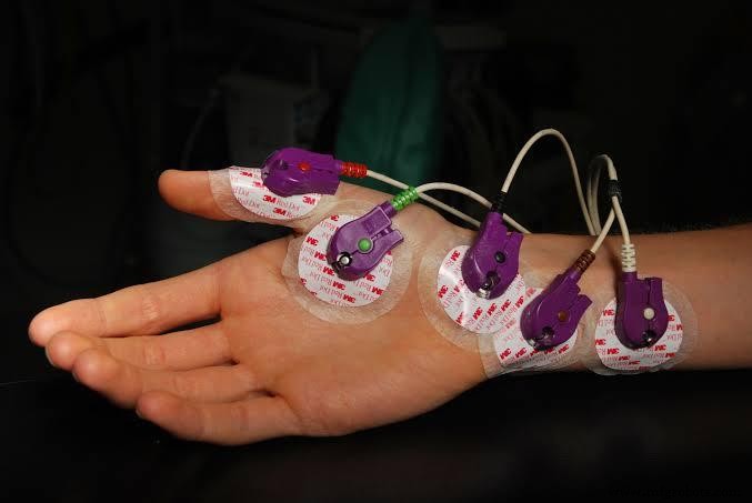 EMG-Sensor erklärt: Funktionsweise & Praktische Anwendungen